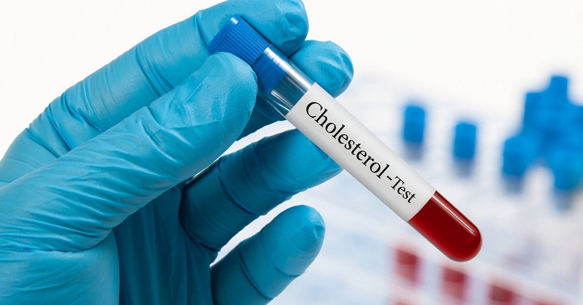 cholesterol test in Midlands
