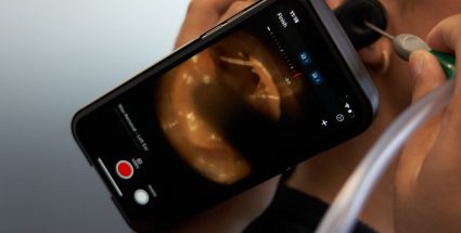How Ear Wax Removal Can Transform Your Listening Experience
